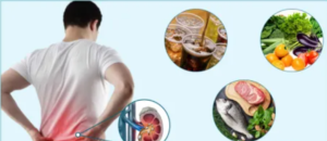 Can Your Diet Influence Kidney Stone Formation?